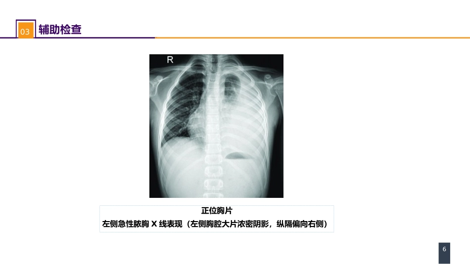 外科学：胸壁、胸膜疾病 案例分析-急性脓胸_第6页