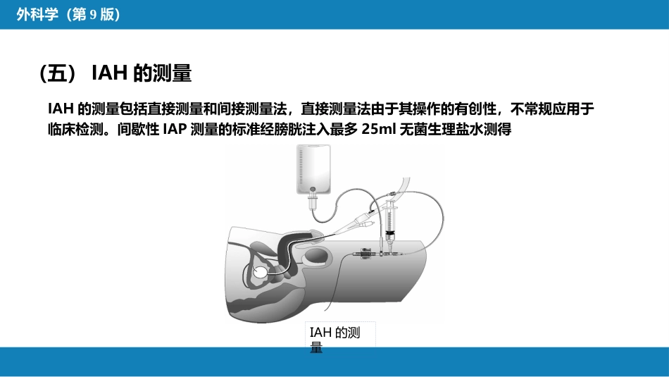 急性化脓性腹膜炎 第三节 腹腔间隔室综合征_第13页