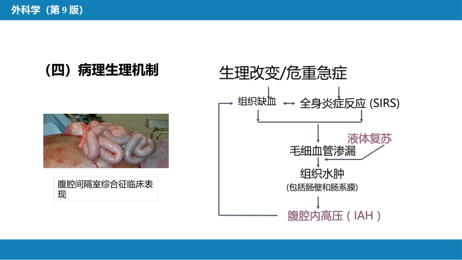 急性化脓性腹膜炎 第三节 腹腔间隔室综合征_第7页