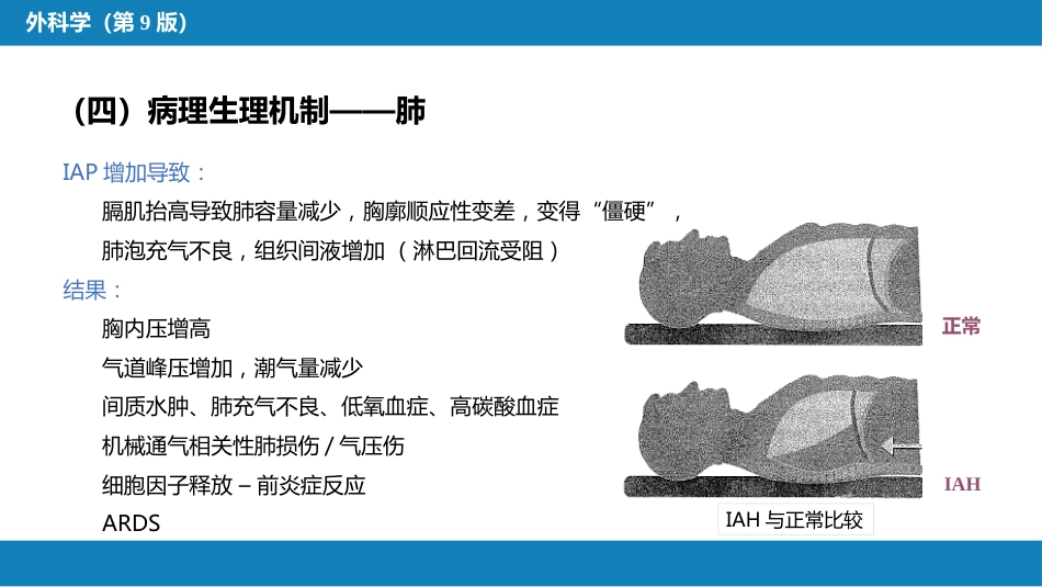 急性化脓性腹膜炎 第三节 腹腔间隔室综合征_第9页