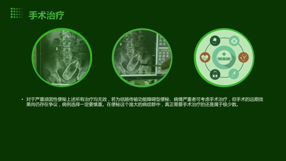 便秘疾病PPT演示课件_第14页