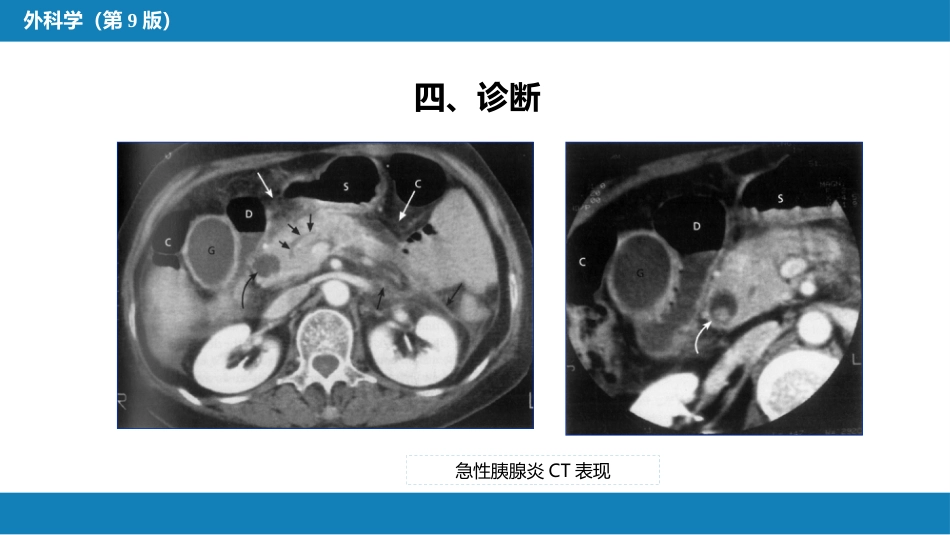 胰腺疾病 第四十一章 第一、二节_第14页