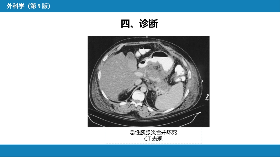 胰腺疾病 第四十一章 第一、二节_第15页