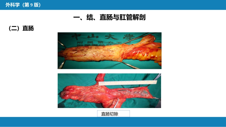结、直肠与肛管疾病 第一、二、三节_第14页