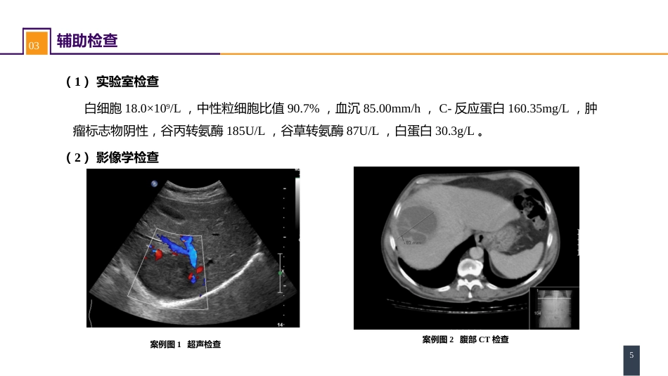 肝疾病 案例分析-肝脓肿_第5页