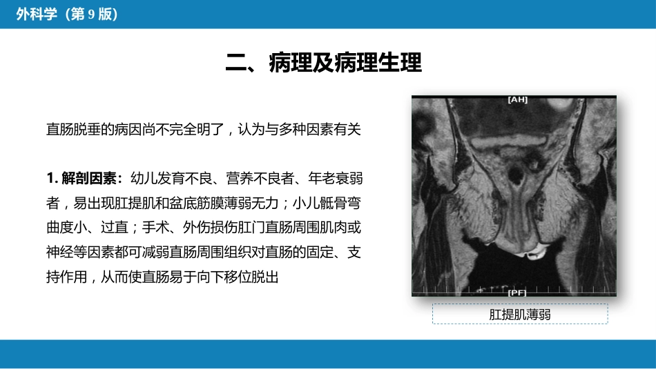 结、直肠与肛管疾病 第十三节 直肠脱垂_第5页