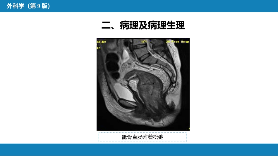 结、直肠与肛管疾病 第十三节 直肠脱垂_第9页