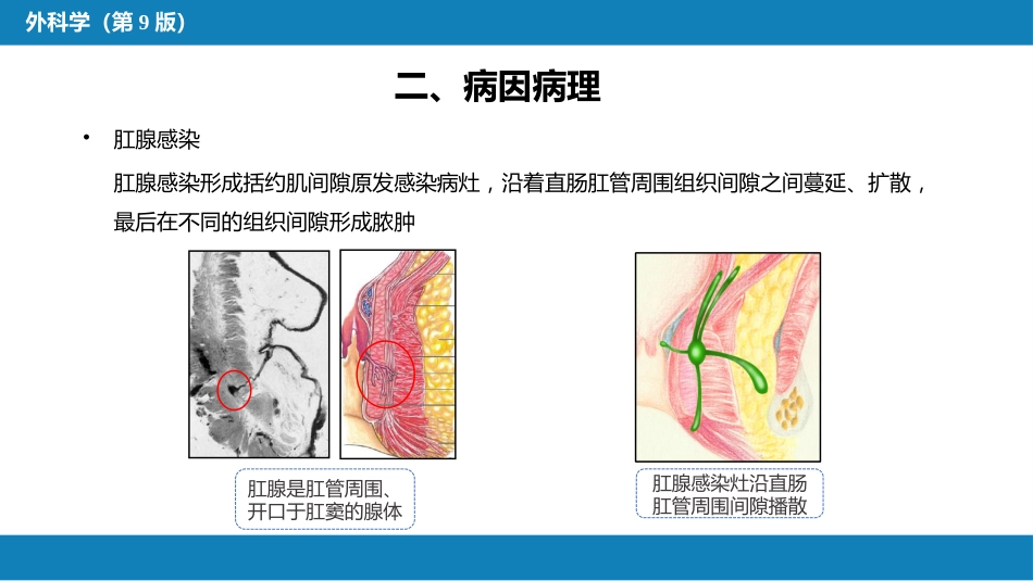 结、直肠与肛管疾病 第九、十、十一节_第12页