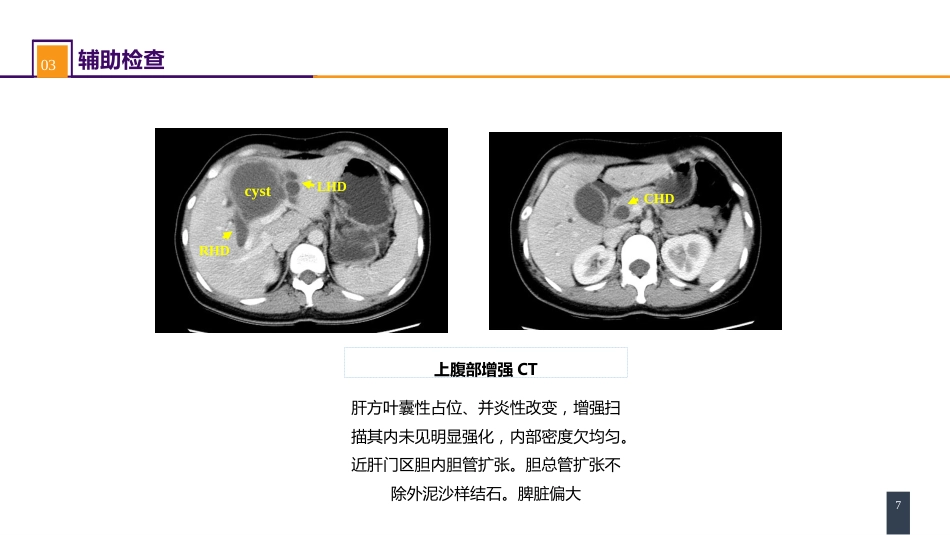 肝疾病 案例分析-囊型肝包虫病合并胆瘘的诊疗_第7页