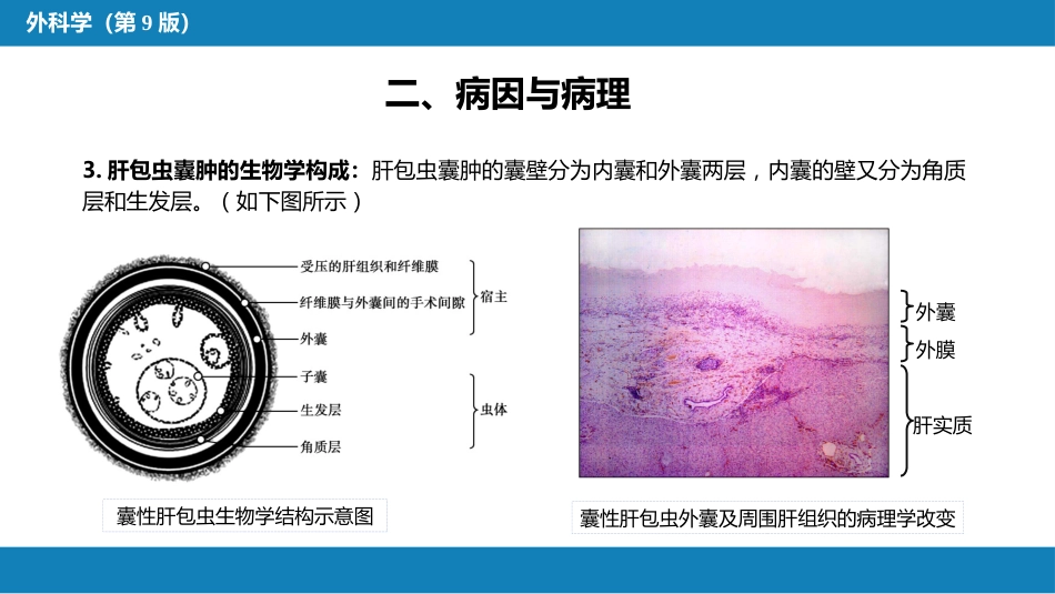肝疾病 第四节 肝棘球蚴病_第6页