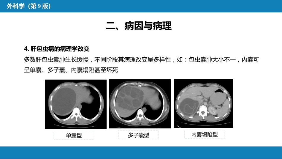 肝疾病 第四节 肝棘球蚴病_第7页