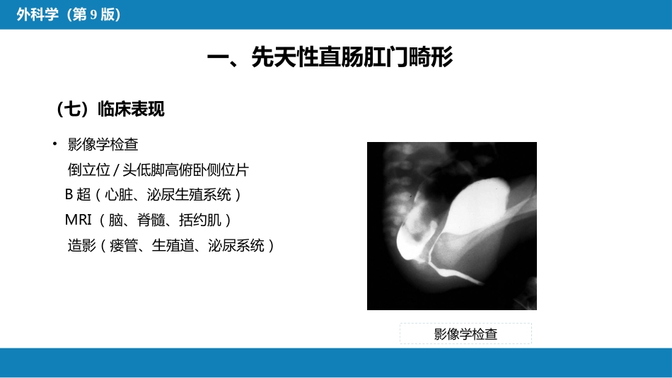 结、直肠与肛管疾病 第八节 结直肠和肛管疾病_第15页