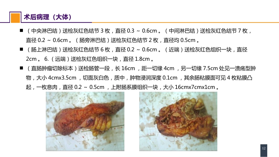 结、直肠与肛管疾病 案例分析-直肠癌_第12页
