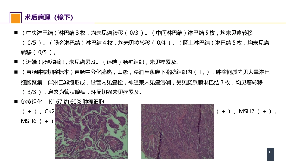 结、直肠与肛管疾病 案例分析-直肠癌_第13页