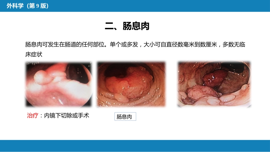 结、直肠与肛管疾病 第四、五节_第12页