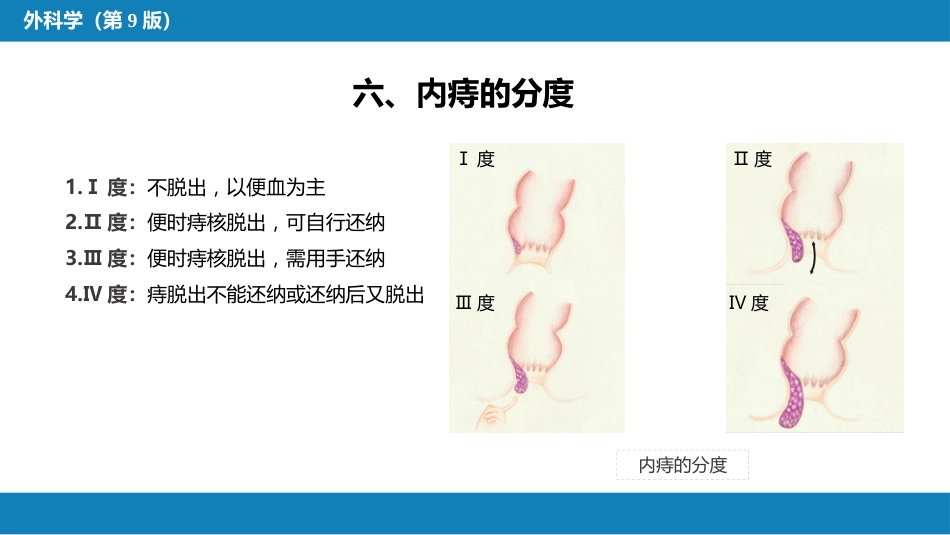 结、直肠与肛管疾病 第十二节 痔_第9页