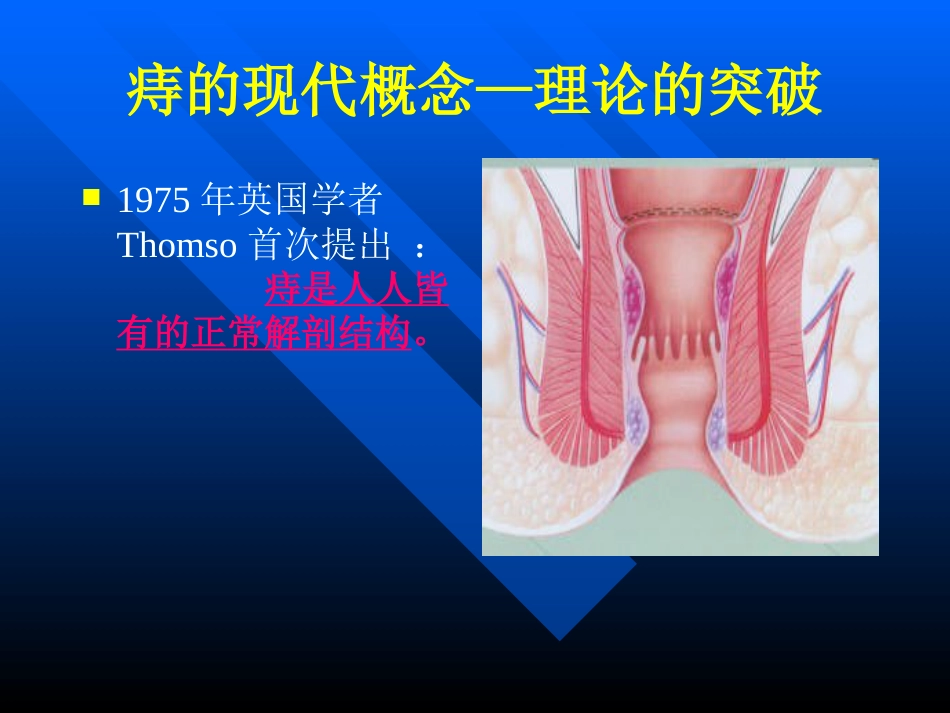 pph—治疗痔疮的新技术 ppt课件-医学资料_第2页