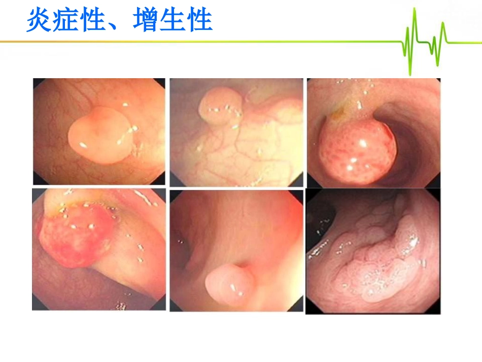 emr治疗肠道息肉_第7页