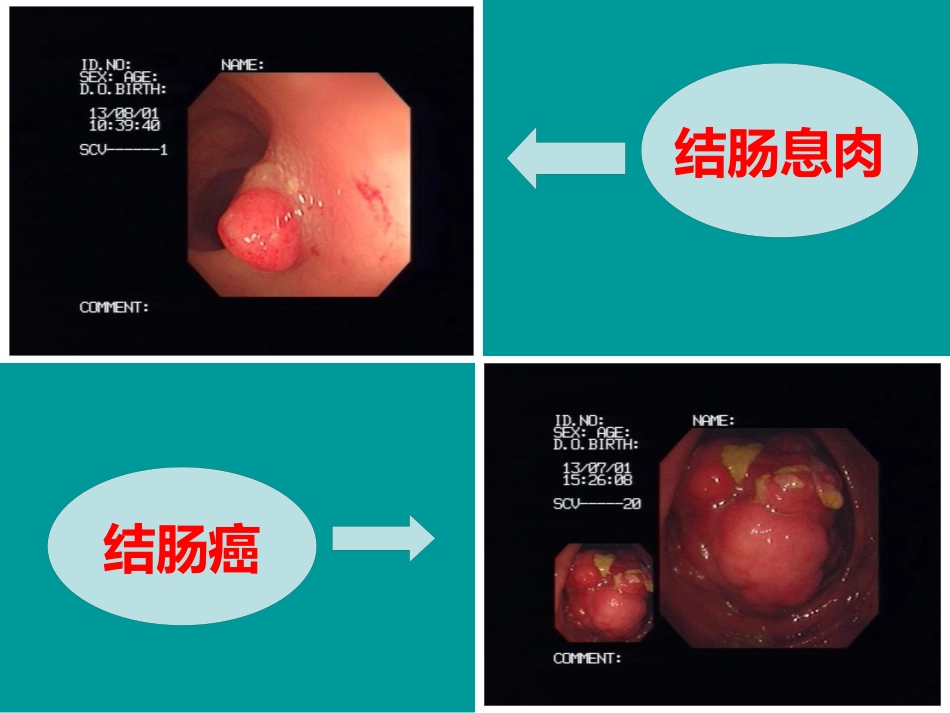 便秘的基本知识_第7页
