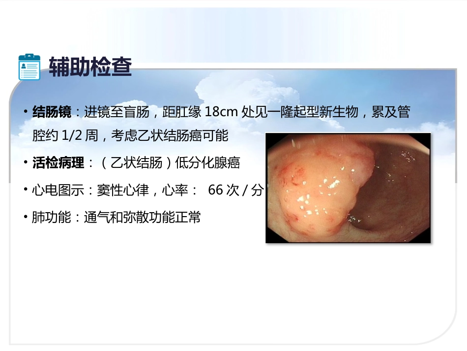 III期结肠癌患者诊断与治疗_第4页