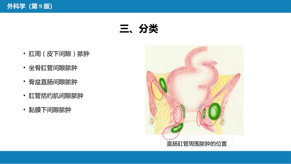 结、直肠与肛管疾病 第九、十、十一节 (1)_第14页