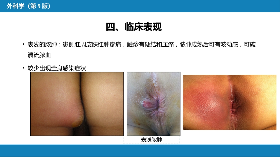 结、直肠与肛管疾病 第九、十、十一节 (1)_第15页