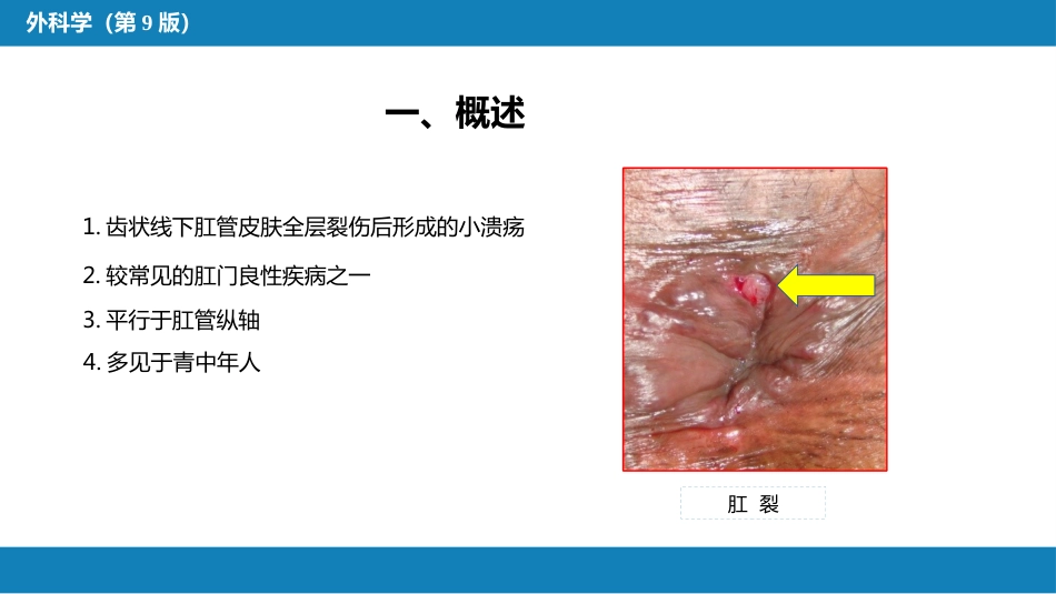 结、直肠与肛管疾病 第九、十、十一节 (1)_第4页