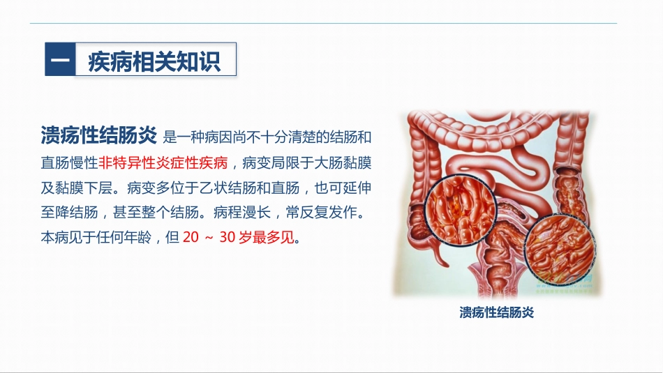 消化内科-溃疡性结肠炎护理查房_第4页