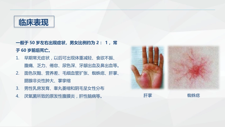消化内科-酒精性肝硬化护理教学查房_第7页