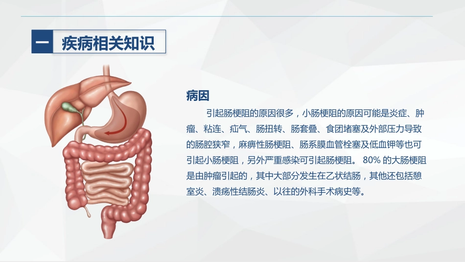 消化内科-肠梗阻护理查房2_第5页