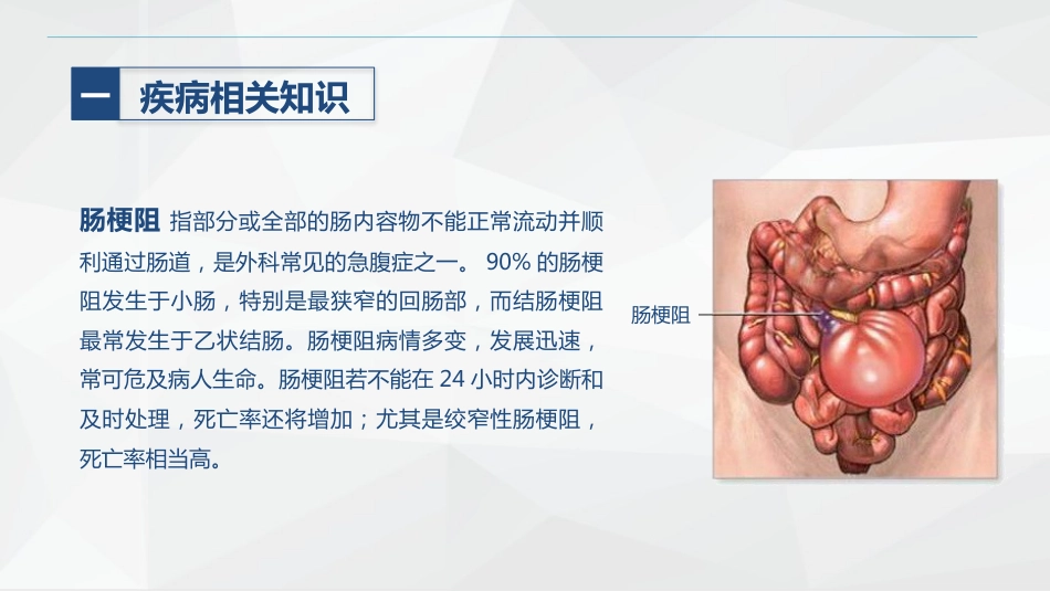 消化内科-肠梗阻护理查房_第4页