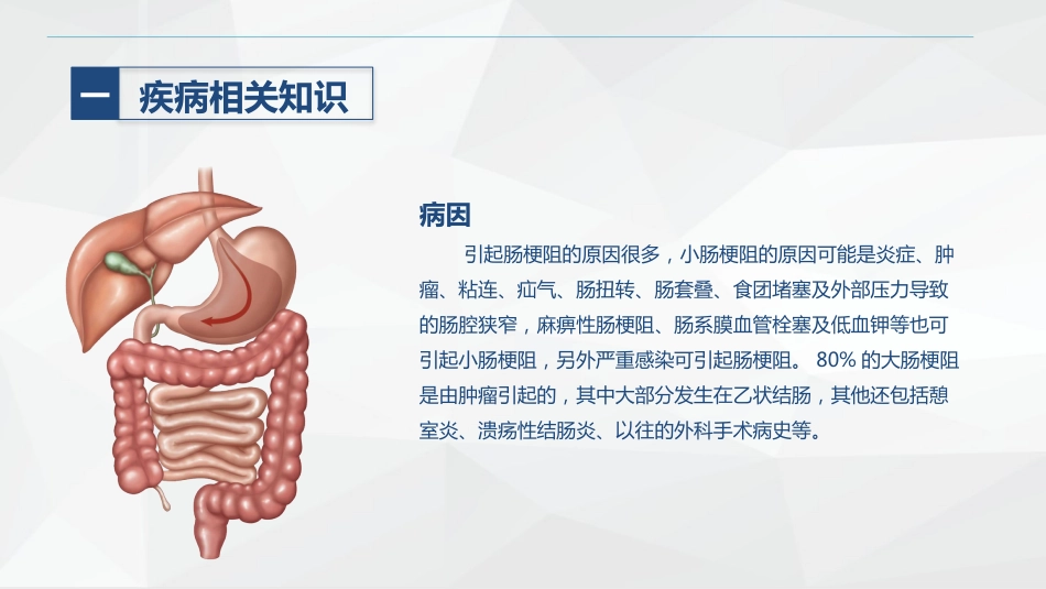 消化内科-肠梗阻护理查房_第5页
