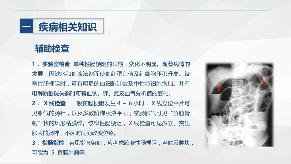 消化内科-肠梗阻护理查房_第9页