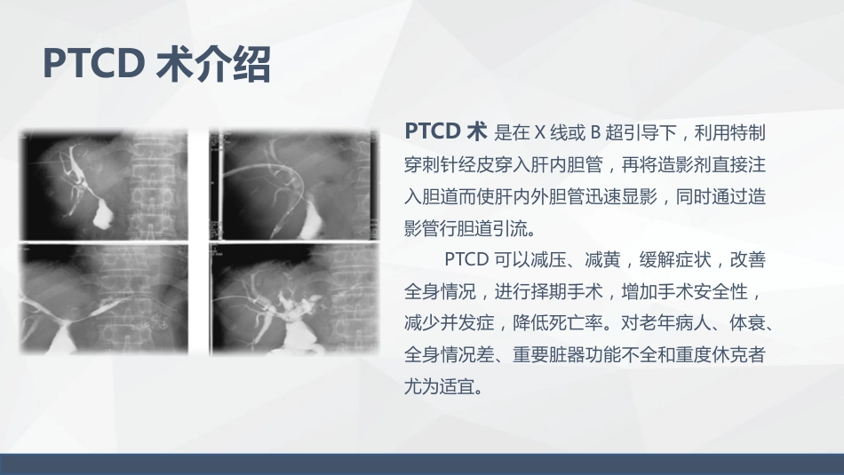 消化科-胰腺癌患者的护理查房_第11页