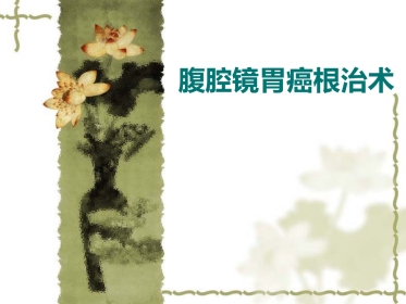 4月腹腔镜胃癌根治术