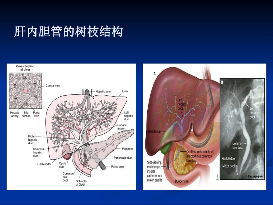 【医学课件】胆道胰腺疾病PPT_第4页