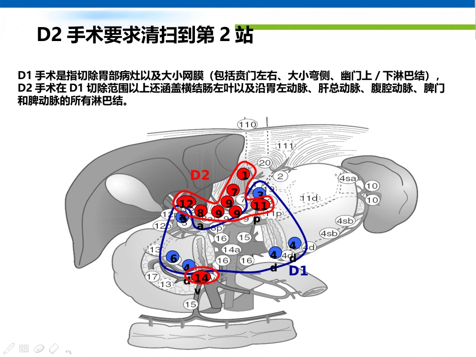 年胃癌诊治策略_第11页