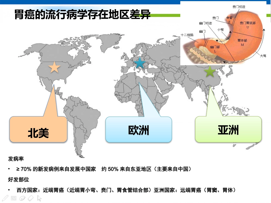 年胃癌诊治策略_第2页