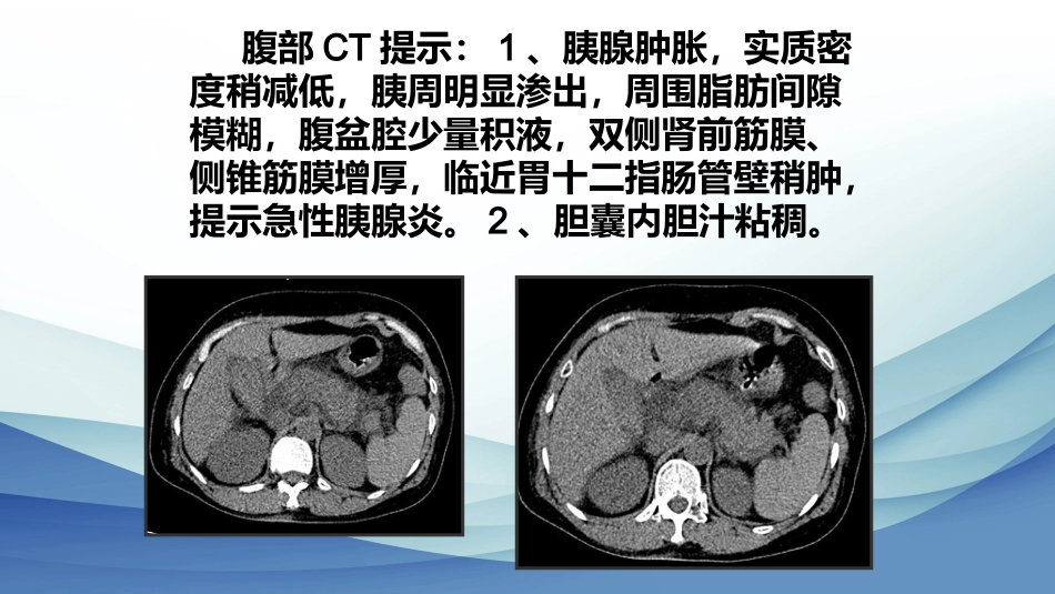 年急性胰腺炎液体复苏_第4页