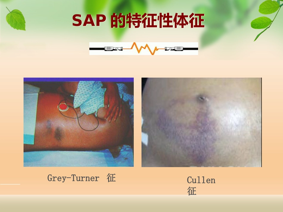 急性胰腺炎_第10页