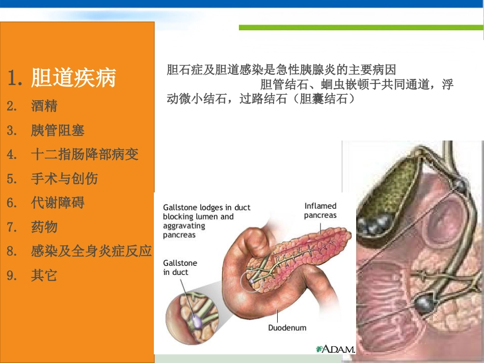 急性胰腺炎(1)_第6页
