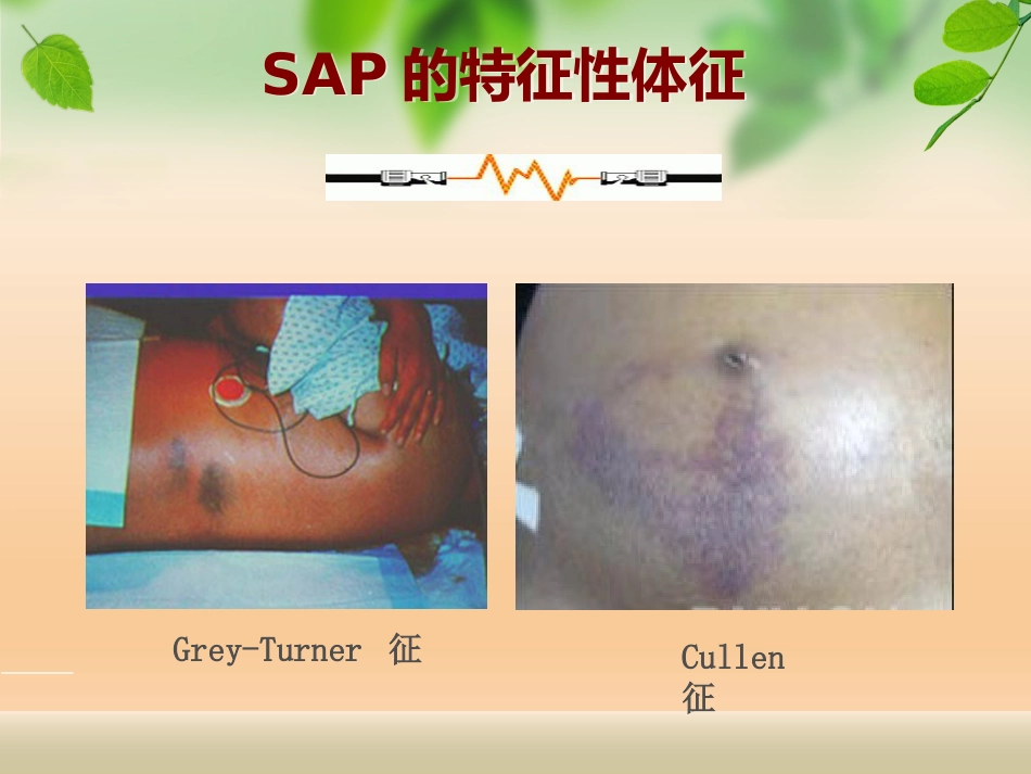 规培讲座急性胰腺炎_第9页