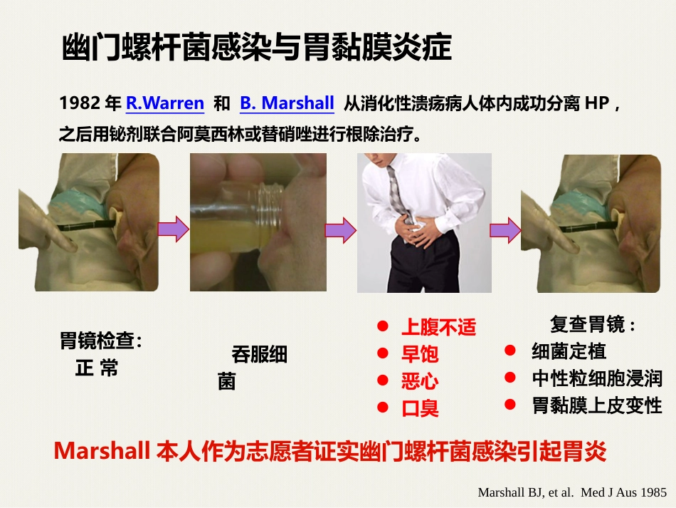 HP感染离胃癌还有多远_第4页