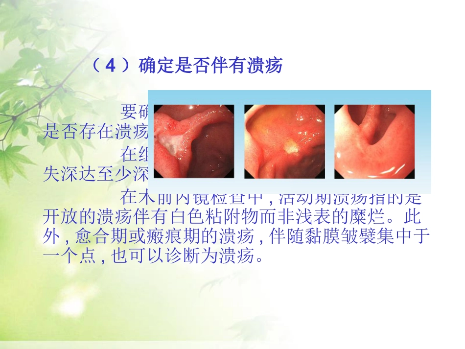 ESD治疗早期胃癌_第12页