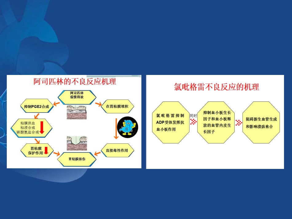 ACS抗栓治疗合并消化道出血的治疗策略_第7页