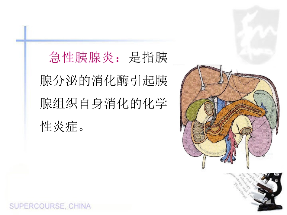 急性胰腺炎 (2)_第2页