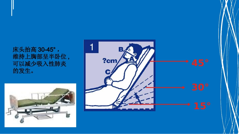 鼻饲患者护理消化内科_第5页