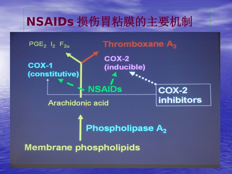 NSAID相关性胃肠病医学PPT_第11页