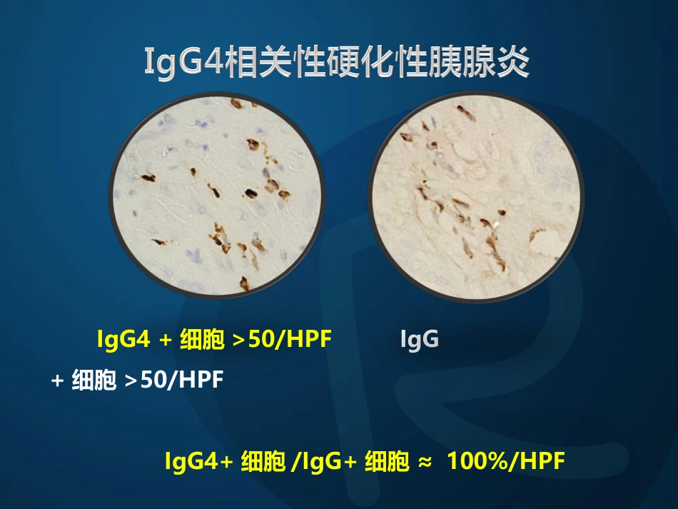 igg相关性胰腺炎_第10页
