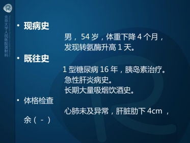 igg相关性胰腺炎